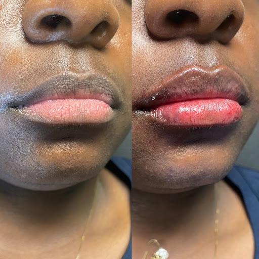 MD Esthetics Peabody