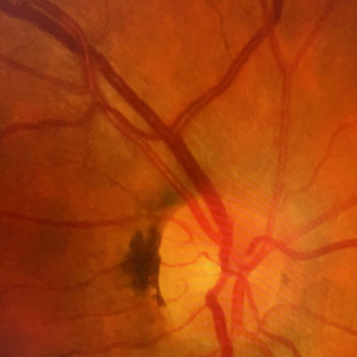 Centro Diagnosi Oculare - Thumbnail