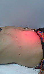 Photo n°14 de Cristina Sanchez acupuncteur 64 à Saint-Martin-d'Arrossa (Acupuncteur)