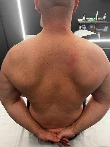 Primal Therapy Colindale Physiotherapy & Sports Injury Clinic - Thumbnail