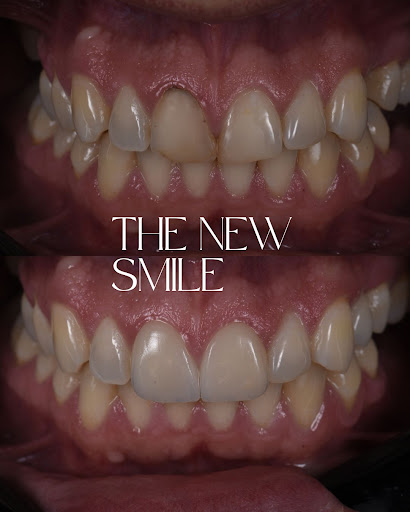 MORA Clínica Dental Badalona - Dentistas especializados