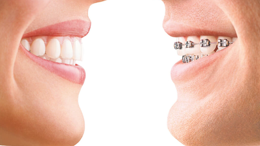 Murphy Orthodontics - Visual