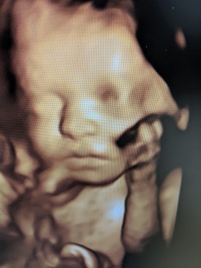 Sweet Baby Face hd 3d 4d ultrasound