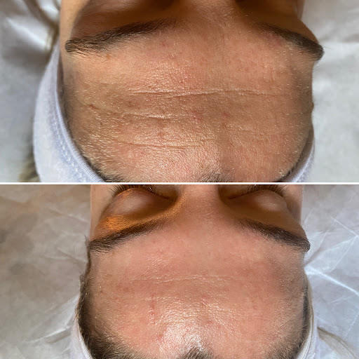 Form AVANA Massage - Thumbnail