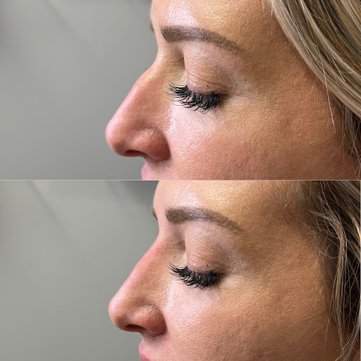 Noir Medical Aesthetics