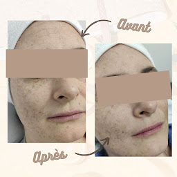 Photo n°20 de JFG Clinic Poitiers à Poitiers (Centre d'amincissement)