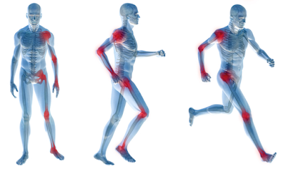 physiotherapist