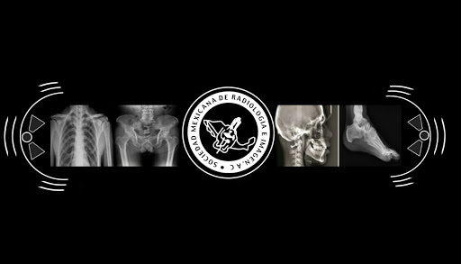RADIOGRAFIA DIGITAL TAPILULA - Thumbnail