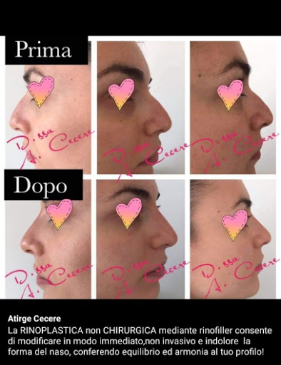 Dott.ssa Atirge Cecere, Chirurgo maxillo facciale - Thumbnail