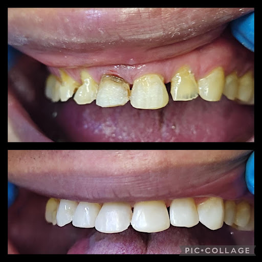 Dental Krysli - Thumbnail