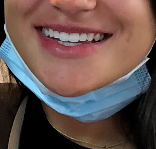 The Whitening Clinic - Thumbnail