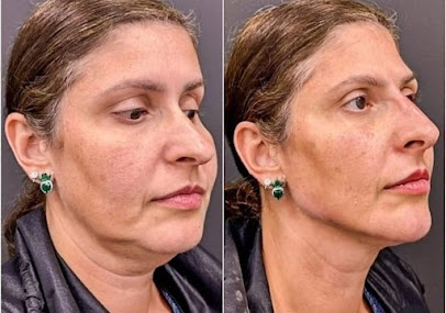 Dra. Isabella Riggo Harmonização Facial