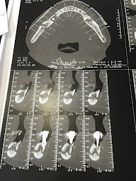 Photo n°17 de Dr Sophie Samama Toubiana-CABINET CIPRIANI à Saint-Ouen-sur-Seine (Dentiste)