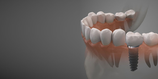 My Bloomingdale Dentist - Thumbnail