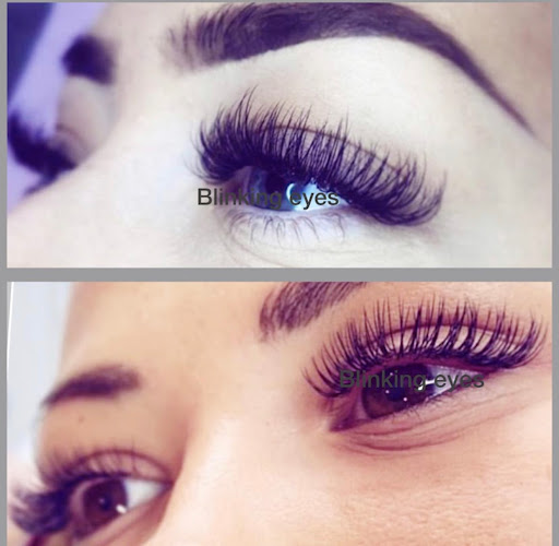 NS Clinic - Lip filler - Botox - Fat dissolve -Laser-skin booster - Eyelash extension - Dermaplanning- Microneedling