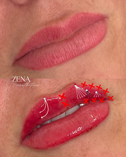 Zena Aesthetics