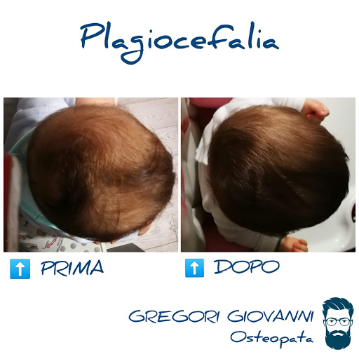 Fisioterapia e Osteopatia Gregori Giovanni - Thumbnail