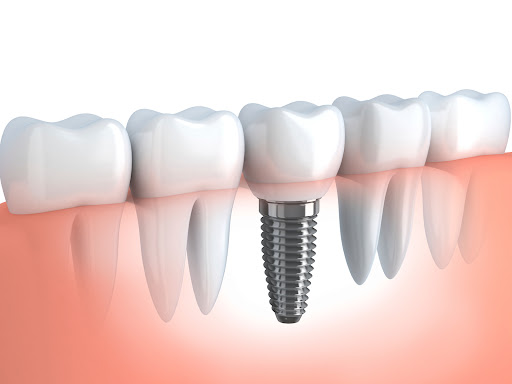 Norco Hills Advanced Dentistry - Thumbnail