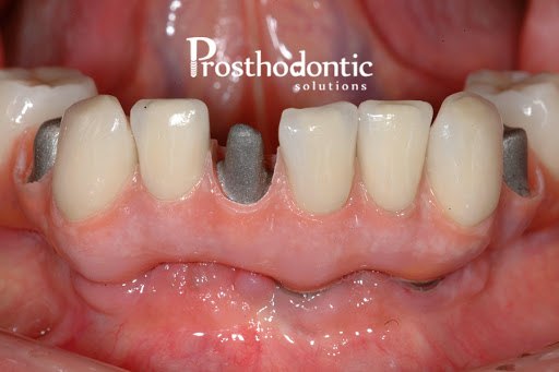 Prosthodontic Solutions-Dr. Michael Waliszewski - Thumbnail