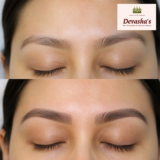 Dreaming of naturally fuller, well-shaped eyebrows that frame your face perfectly? At Devasha's H… post image