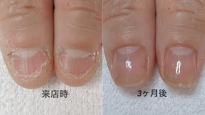 グロッシィネイル | 北九州市戸畑区の自爪育成サロン