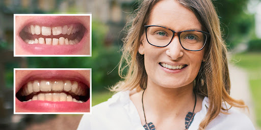DR SMILE® Rivas Vaciamadrid - Covibar - Thumbnail