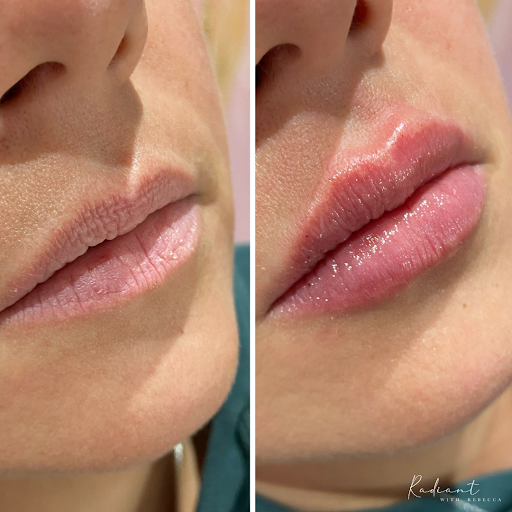 Radiant Med Spa - Radiant with Rebecca