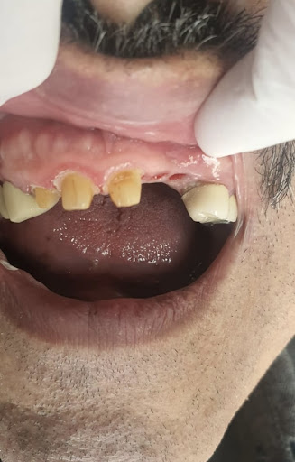 BC Tijuana Clinica Dental Familiar OSONU - Thumbnail