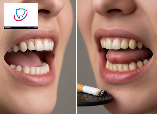 Smoking doesn’t just affect your lungs – it silently damages your gums, teeth and smile. At Dr. A… post image
