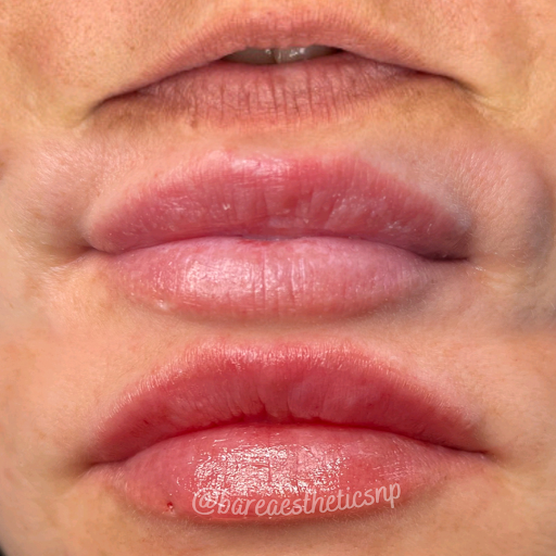 Bare Aesthetics & Wellness