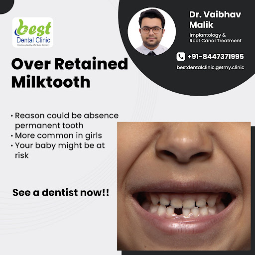 Consult a dentist as soon as your baby comes at age of 6. You can prevent deciduous tooth if you… post image