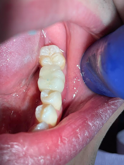 Dental Implants Cambridge