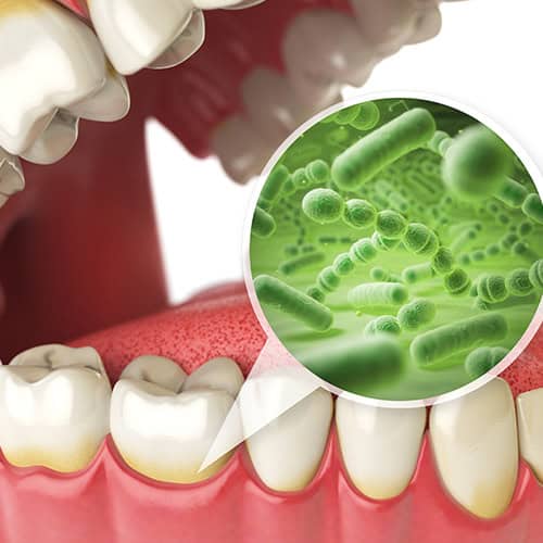 Early Detection of Dental Issues 🦷