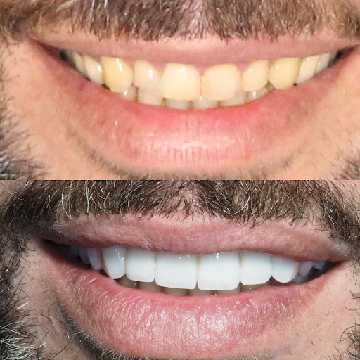 Clínica Dental Bibiana García - Clínica Dental en Algeciras - Thumbnail