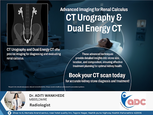 CT Urography and Dual Energy CT provide precise imaging for diagnosing renal calculus, offering d…