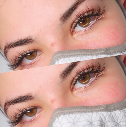 A List Beauty Sydney - eyelash extensions - Thumbnail