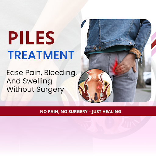 Say goodbye to the discomfort of piles with safe & effective Homeopathy treatment. Homeopathy foc… post image