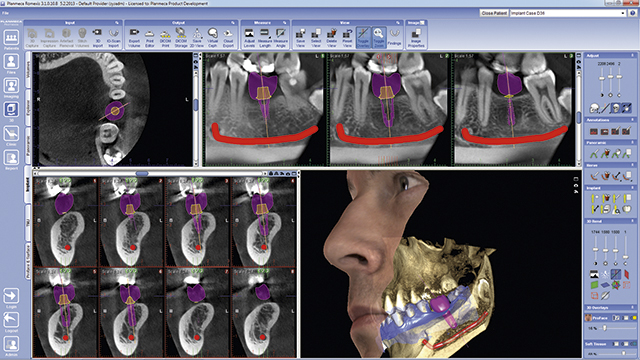 KRANEX CENTRO DE TOMOGRAFIAS ODONTOLOGICAS, Author: KRANEX CENTRO DE TOMOGRAFIAS ODONTOLOGICAS