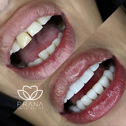 Prana Smile Design