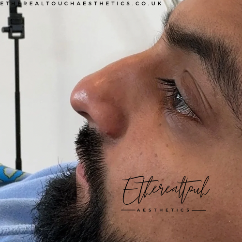 Etherealtouch Aesthetics - Thumbnail