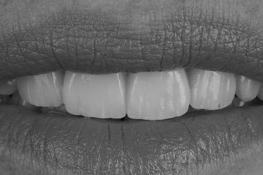 Maxila Clinica Dental Valencia - Thumbnail