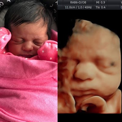 Sweet Baby Face hd 3d 4d ultrasound