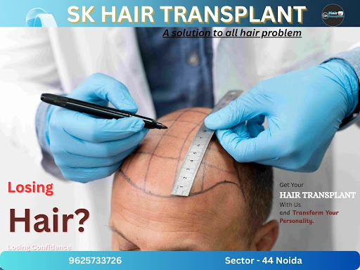 Are you looking for economical hair transplant services? SK Hair Transplant Clinic in Sector 44,… post image