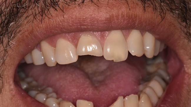 Αξιολογήσεις για το Smile Design Οδοντίατροι Καλαμαριά στην Καλαμαριά - Οδοντίατρος