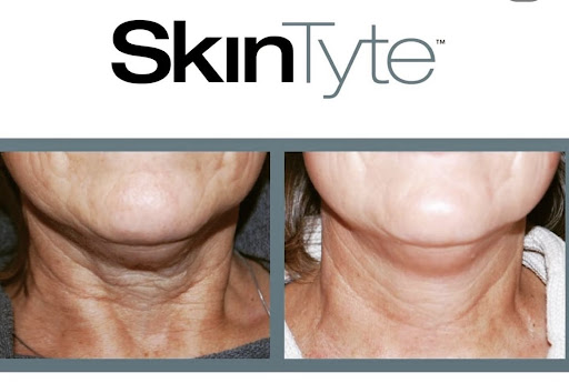 Clove Lakes Laser Center & Medical Spa - Thumbnail
