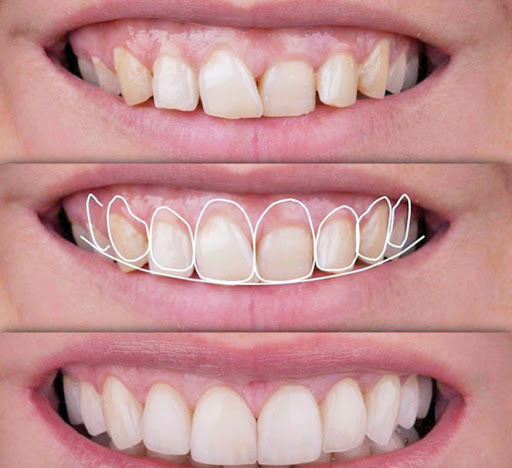Dentistas en Queretaro HADENTAL Gallery - Mexico
