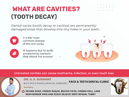 Cavities can be challenging to detect in their early stages. Often, they start as tiny, painless… post image