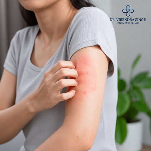 Are sudden itchy rashes, redness or swelling disturbing your daily life? Hives and chronic urtica… post image
