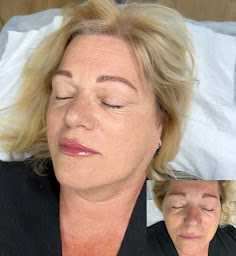 Photo n°3 de CHM DERMO à Yvetot (Clinique de maquillage permanent)