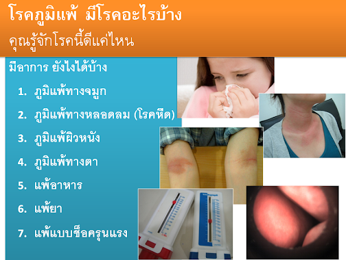 คลินิกภูมิแพ้ Allergy Care Clinic บิ๊กซี สะพานควาย, Author: คลินิกภูมิแพ้ Allergy Care Clinic บิ๊กซี สะพานควาย